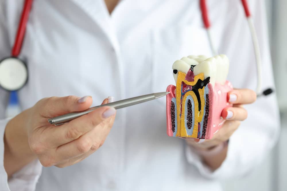 Tooth decay repair Hamilton