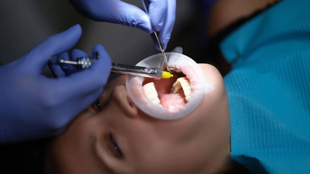 Gum surgery Hamilton