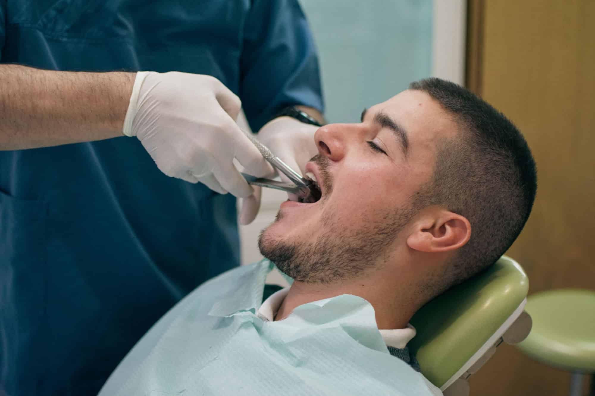 Wisdom teeth removal Hamilton