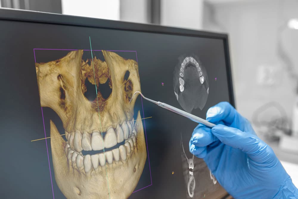 Safe dental X-rays Hamilton