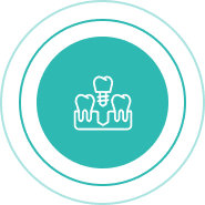 Permanent teeth replacement Hamilton