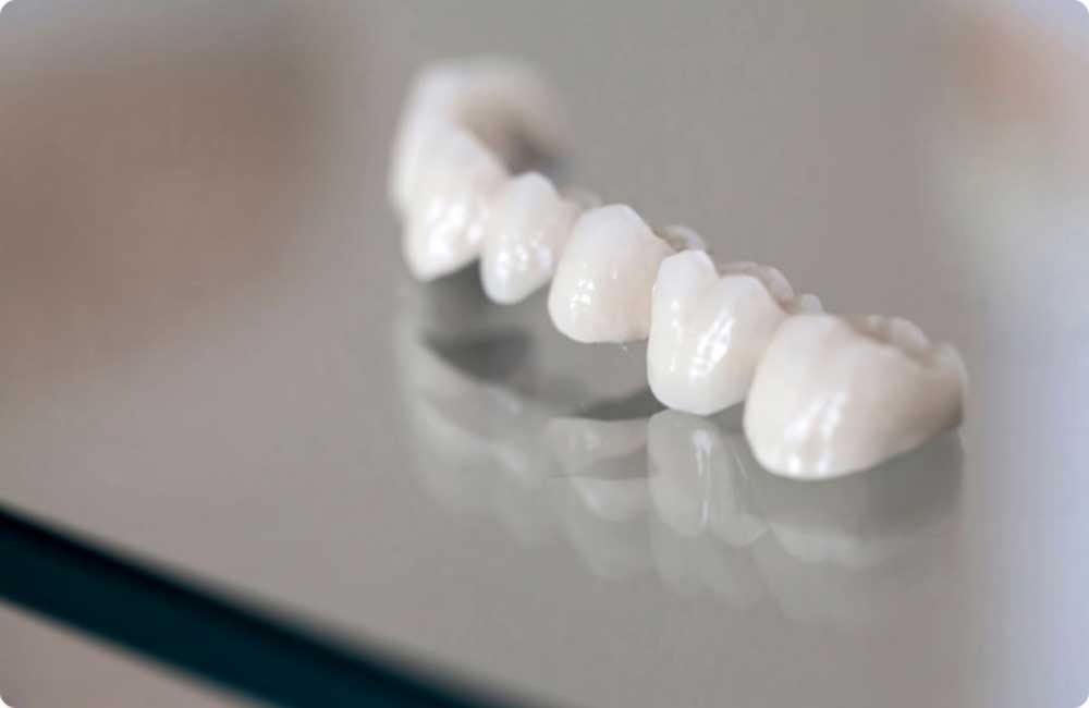 Dental crown services Hamilton