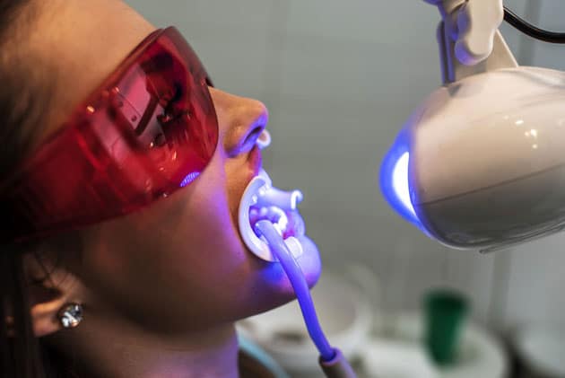 Professional teeth whitening Hamilton