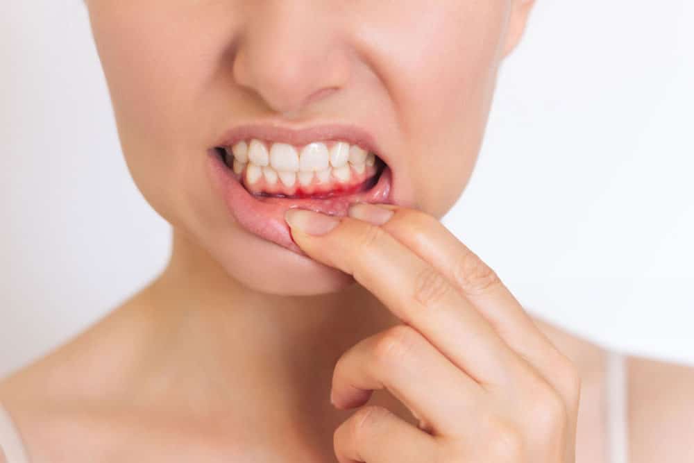 Gum disease Hamilton